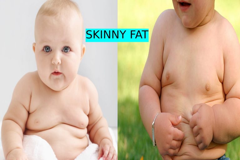 What is “Skinny Fat” Mean? – Meaning, Difference, Look, And More