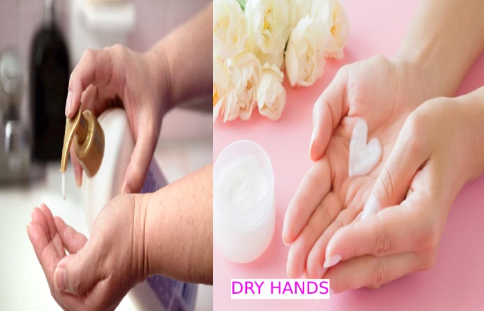 DRY HANDS