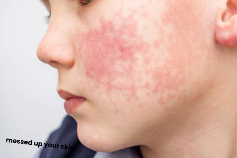 Twelve Things Messed Up Your Skin