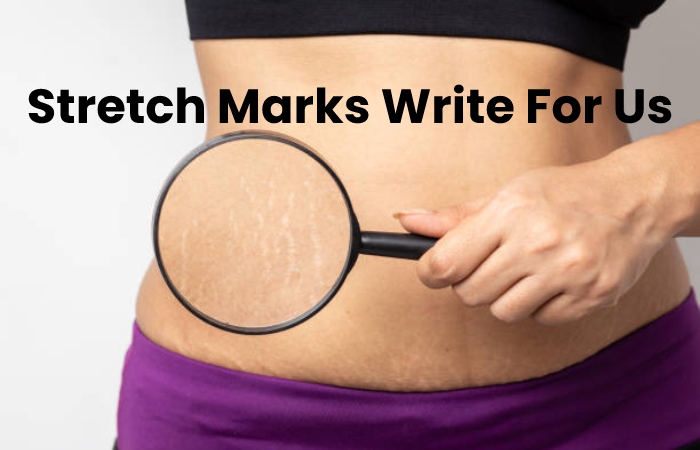 Stretch Marks Write For Us (1)