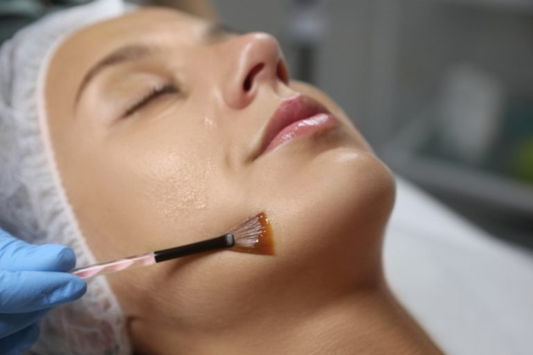 Unlocking Ageless Beauty: The Secrets of Skin Health through Modern Techniques and Chemical Peels