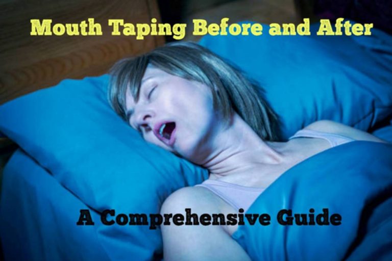 mouth taping before and after